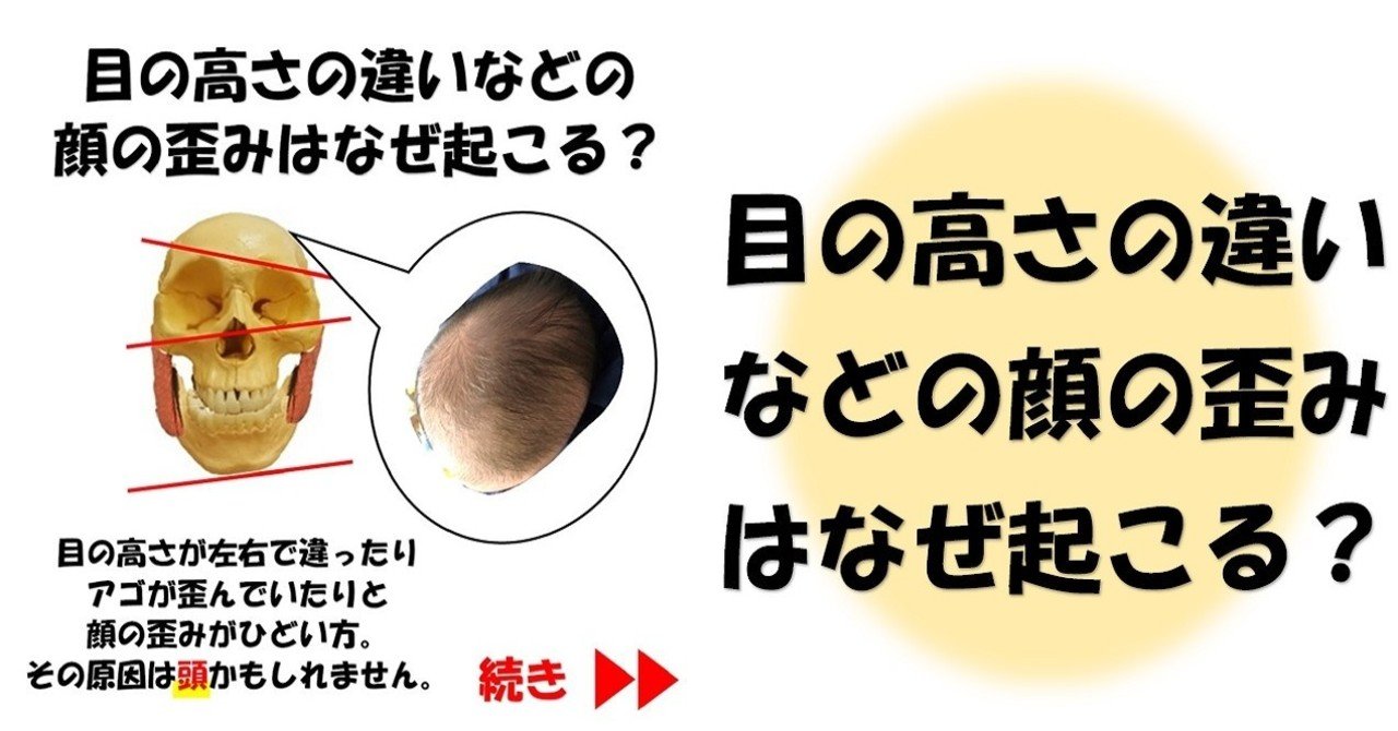 目の高さの違いなどの顔の歪みはなぜ起こる Revisionginza Note