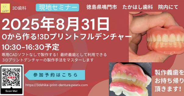 フリーハンドのⅡ級窩洞CR充填 3D printer technique 歯科 脱マトリックス！フリーハンドのII級窩洞CR充填 3D printer