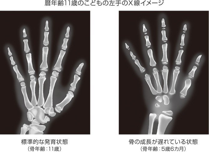 フィジカルコーチとして育成年代にできる事vol 3 成長過程と個人差 宮脇晴己 フィジカルコーチ Note