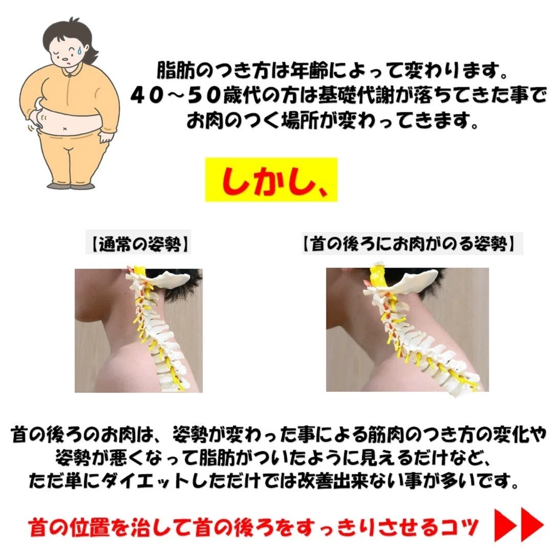 首 の 後ろ の 肉