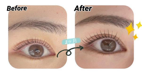 目元のケアがこれ一本で。『LASH LINK EYELASH SERUM (ラッシュリンク