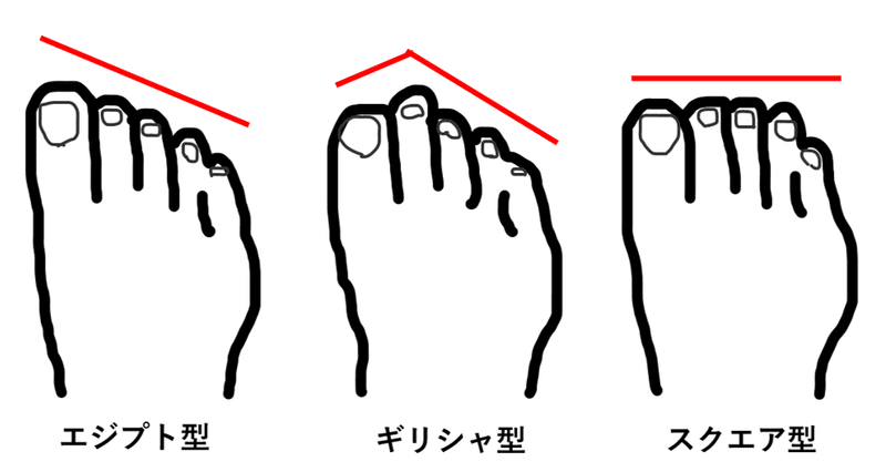 中足骨頭部痛の原因 Y K Note