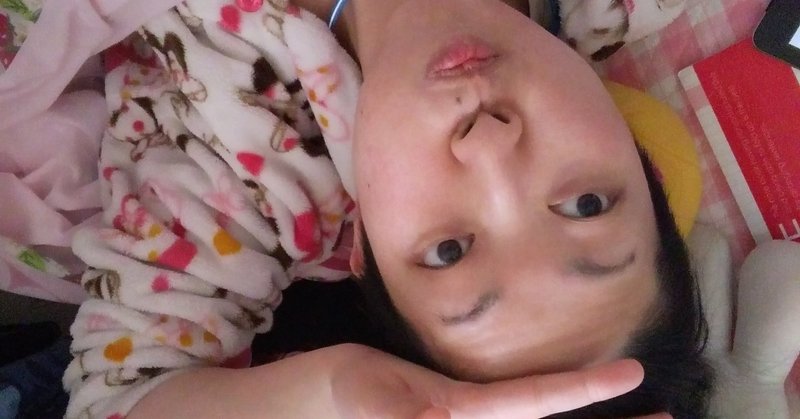 宮崎鈴子からアトピーやアレルギーでマスクができない人へ 宮崎鈴子によるマスクしないバカとマスク出来ない人の違い 宮崎鈴子 Note