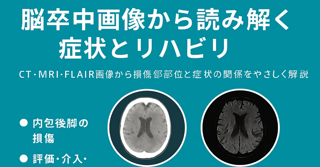 脳卒中画像から読み解く症状とリハビリ CT・MRI・FLAIR画像から損傷部位と症状の関係をやさしく解説｜taka@理学療法士