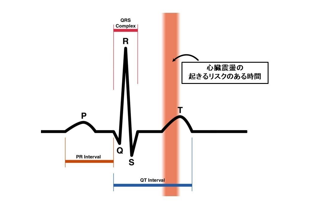 心臓震盪 しんぞうしんとう ってなに Shingo Note 心臓震盪 しんぞうしんとう ってなに Shingo Note