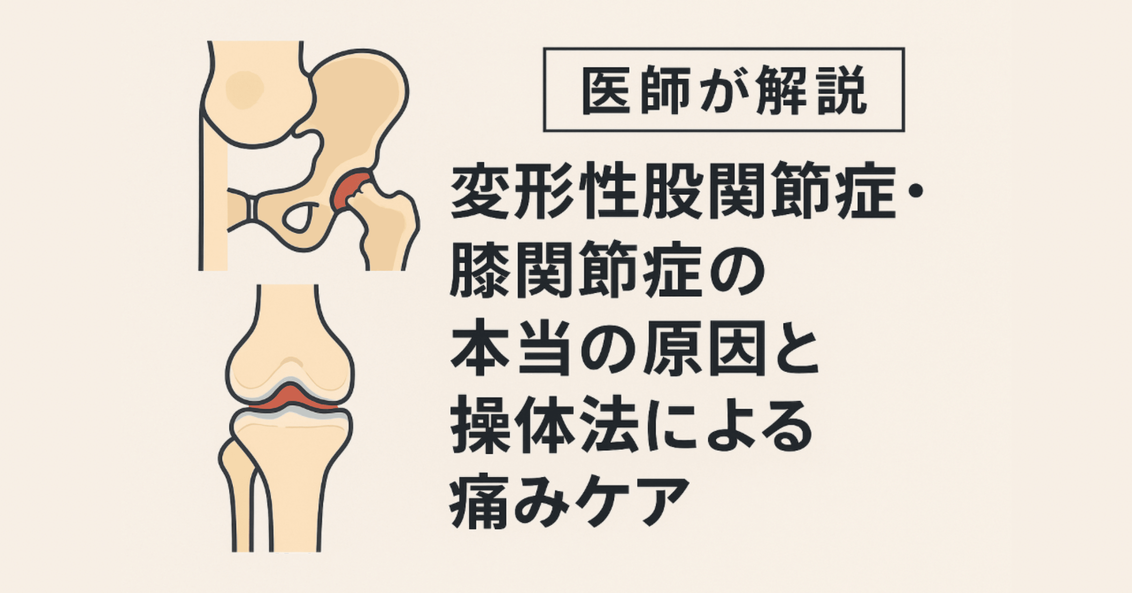 変形性股関節症・膝関節症の本当の原因と操体法による痛みケア