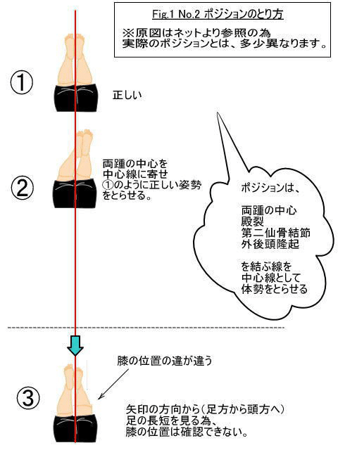 ポジション2における 足の長さの違い 下肢長差の要因 2 ふじの整体院 広島 広島市南区 カイロプラクティック科 ほぐし療法科 Note ポジション2における 足の長さの違い 下肢長差の要因 2 ふじの整体院 広島 広島市南区 カイロプラクティック科 ほぐし療法科 Note
