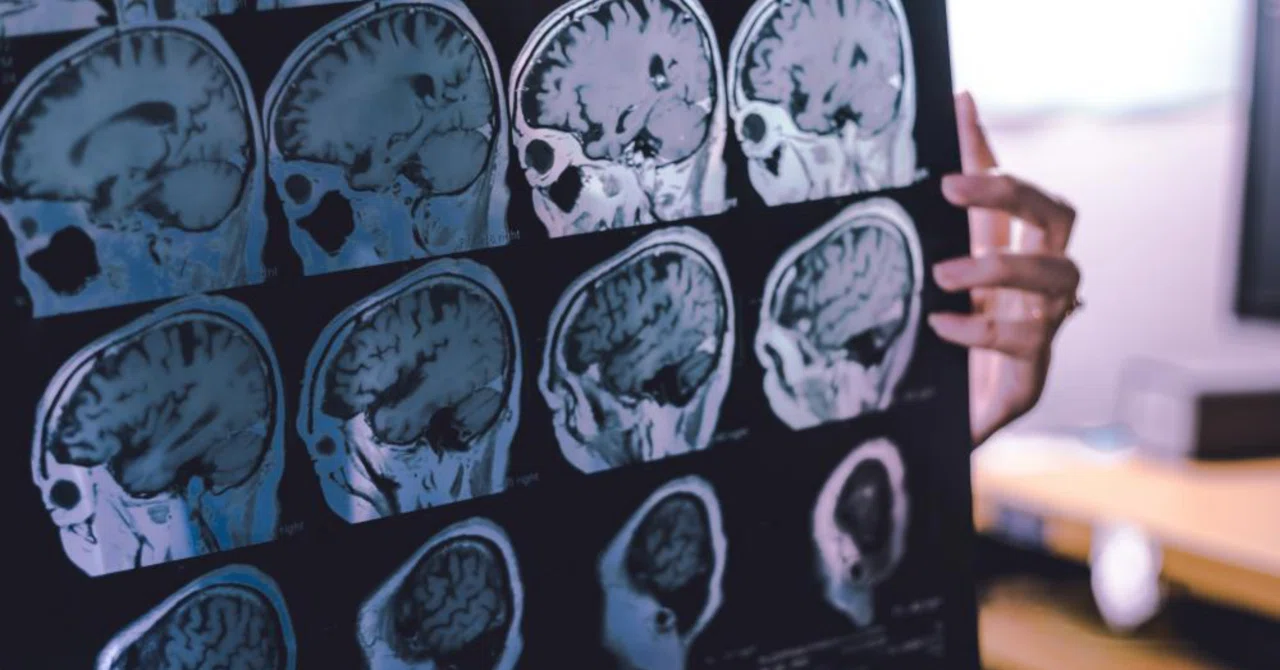 最新｜中年期の心臓の健康状態が悪いと認知症のリスクが高まることが研究で判明
