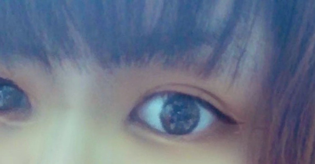 極厚一重まぶたを二重にする方法 東優未 Note