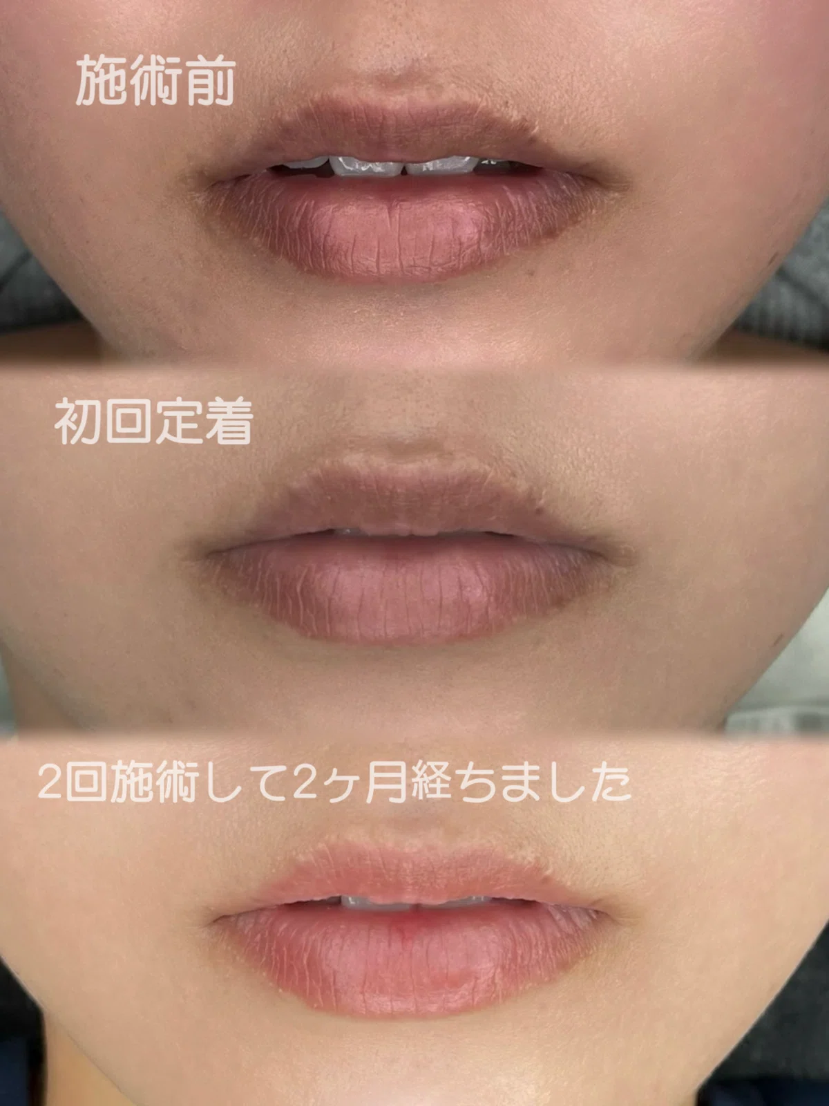[Retention Case Study] I'm happy every day with the great results after ...