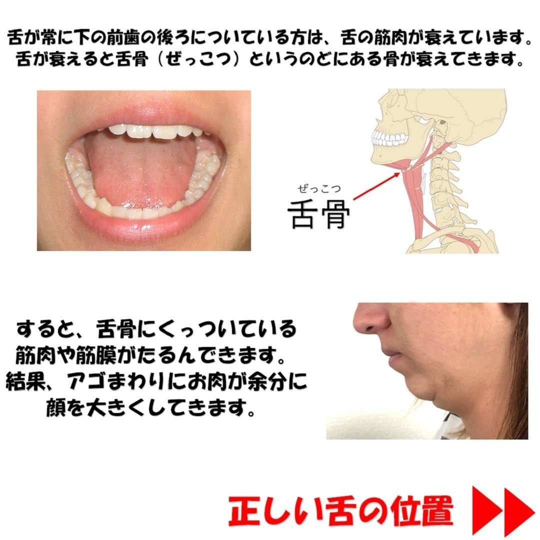 舌を正しい位置に置くだけで月１回の小顔矯正と同じ効果があるって知ってた Revisionginza Note