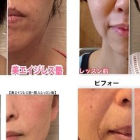 永久保存版 ほうれい線になる原因８つでほうれい線の予防と改善をする方法 プチ整形に頼らずエイジレスを目指す美容家 ｎａｎａ５５歳 Note