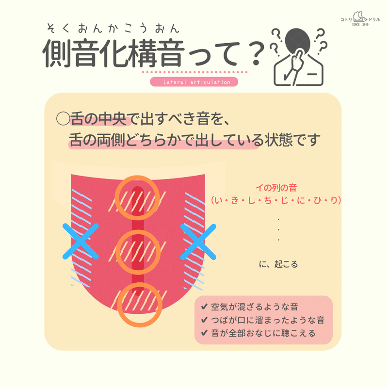 ち し き りが言えない 側音化構音 イ段の発音や滑舌はなおせます てらだ なな なな先生 Note