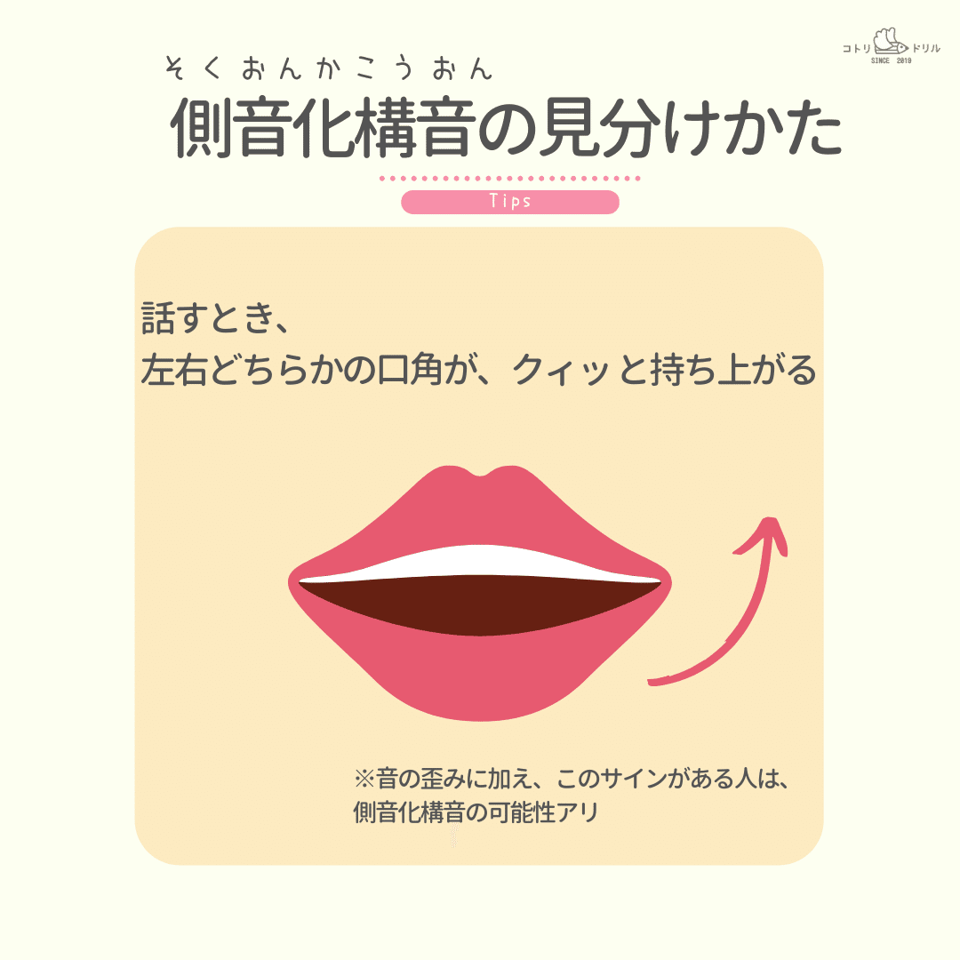 ち し き りが言えない 側音化構音 イ段の発音や滑舌はなおせます 寺田奈々 なな先生 Note