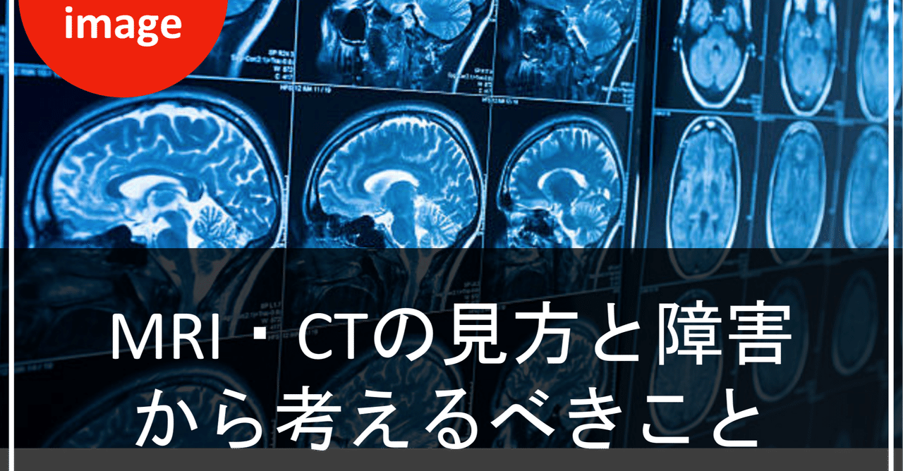 脳梗塞 脳出血におけるct Mriの見方と障害から考えるべきこと 脳外臨床研究会 脳外臨床大学校 Note