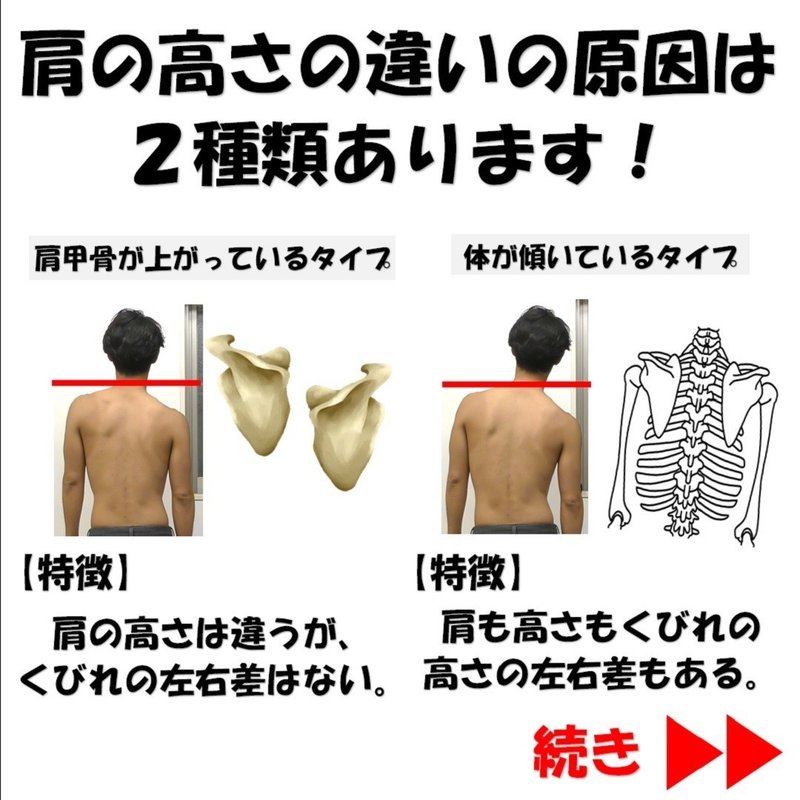 肩の高さを揃えるにはくびれの意識が大事 Revisionginza Note 肩の高さを揃えるにはくびれの意識が大事 Revisionginza Note