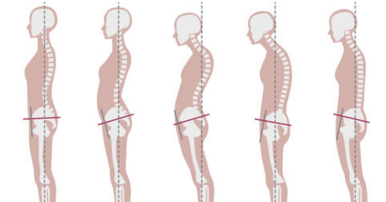 姿勢分析ができると施術の精度が劇的に上がる｜ほぐリッチ・いさ先生/柔道整復師・もみほぐしセラピストスクール講師