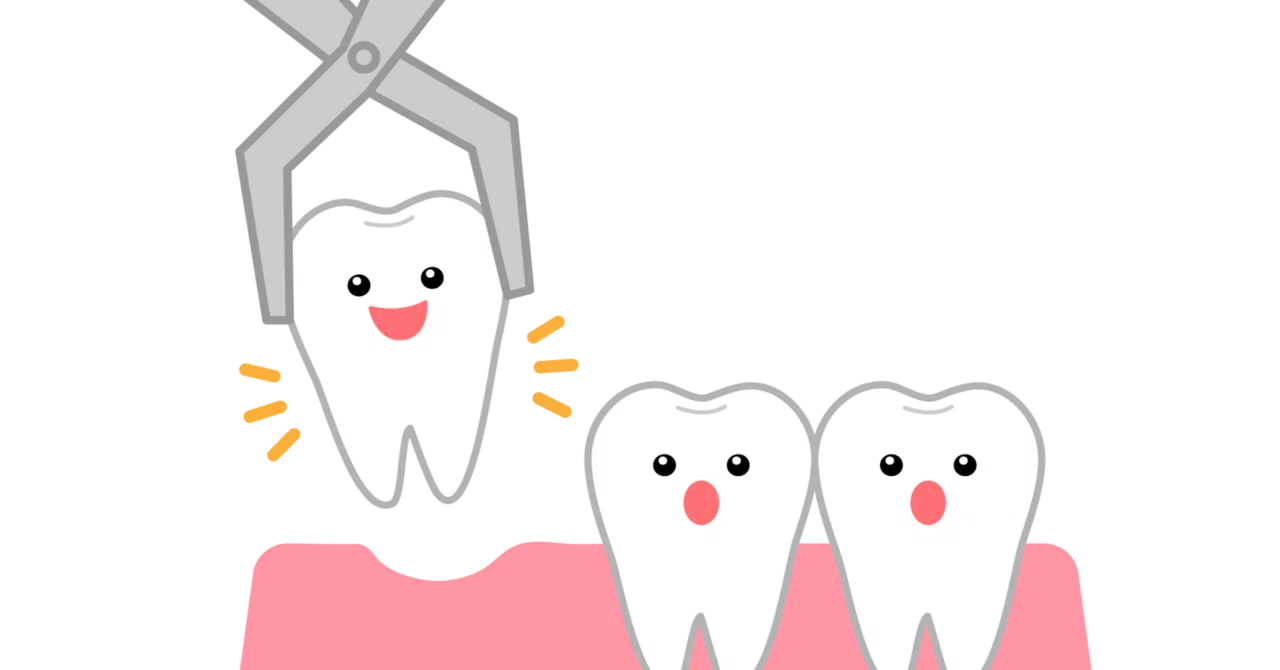 It is so inconvenient to be missing a back tooth｜makoto