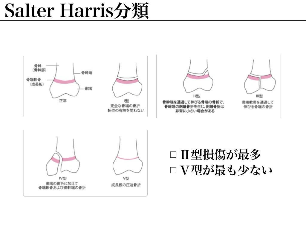 ソルター ハリス 分類