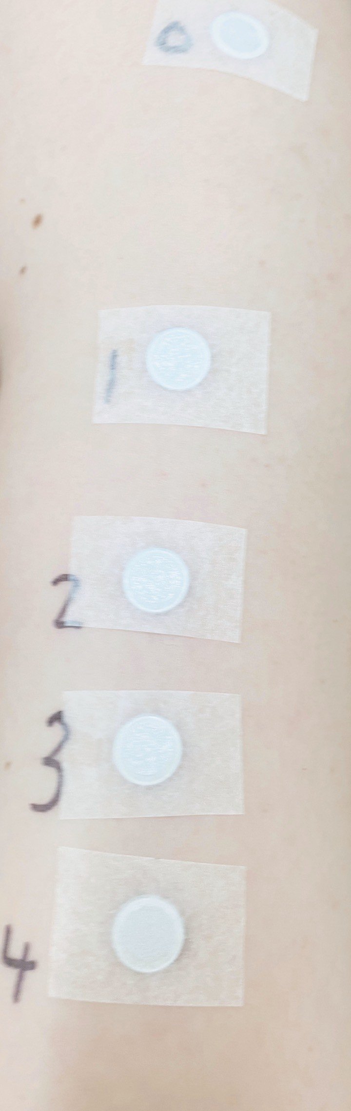 金属アレルギーのパッチテスト 輪 ｒｉｎ Note