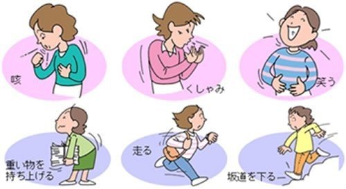 骨盤底筋群の緩みが尿もれの原因 腹圧性尿失禁は予防 改善できる 不二バイオファーム Note 骨盤底筋群の緩みが尿もれの原因 腹圧性尿失禁は予防 改善できる 不二バイオファーム Note