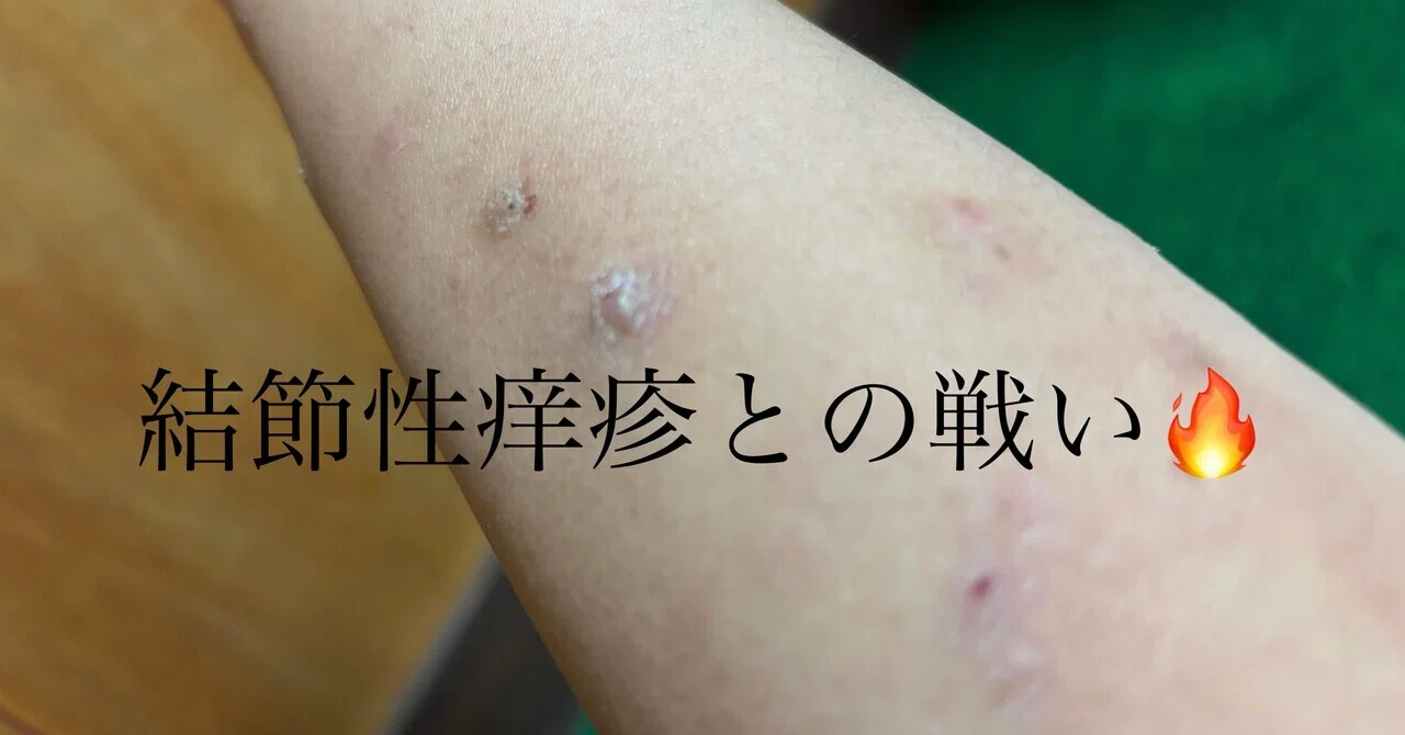 結節性痒疹との戦い｜はぴみる♡