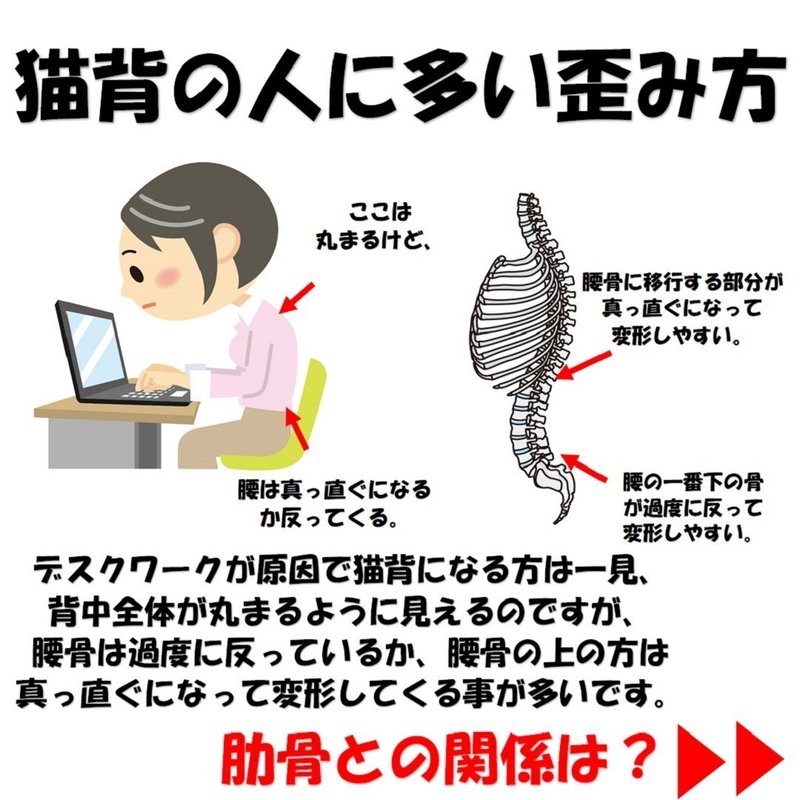 猫背を治すポイントは肋骨の歪みを治す事 Revisionginza Note 猫背を治すポイントは肋骨の歪みを治す事 Revisionginza Note