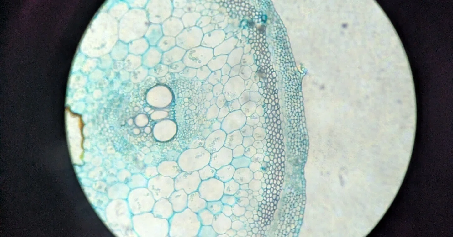 生物実験④細胞の観察251124｜satypalau