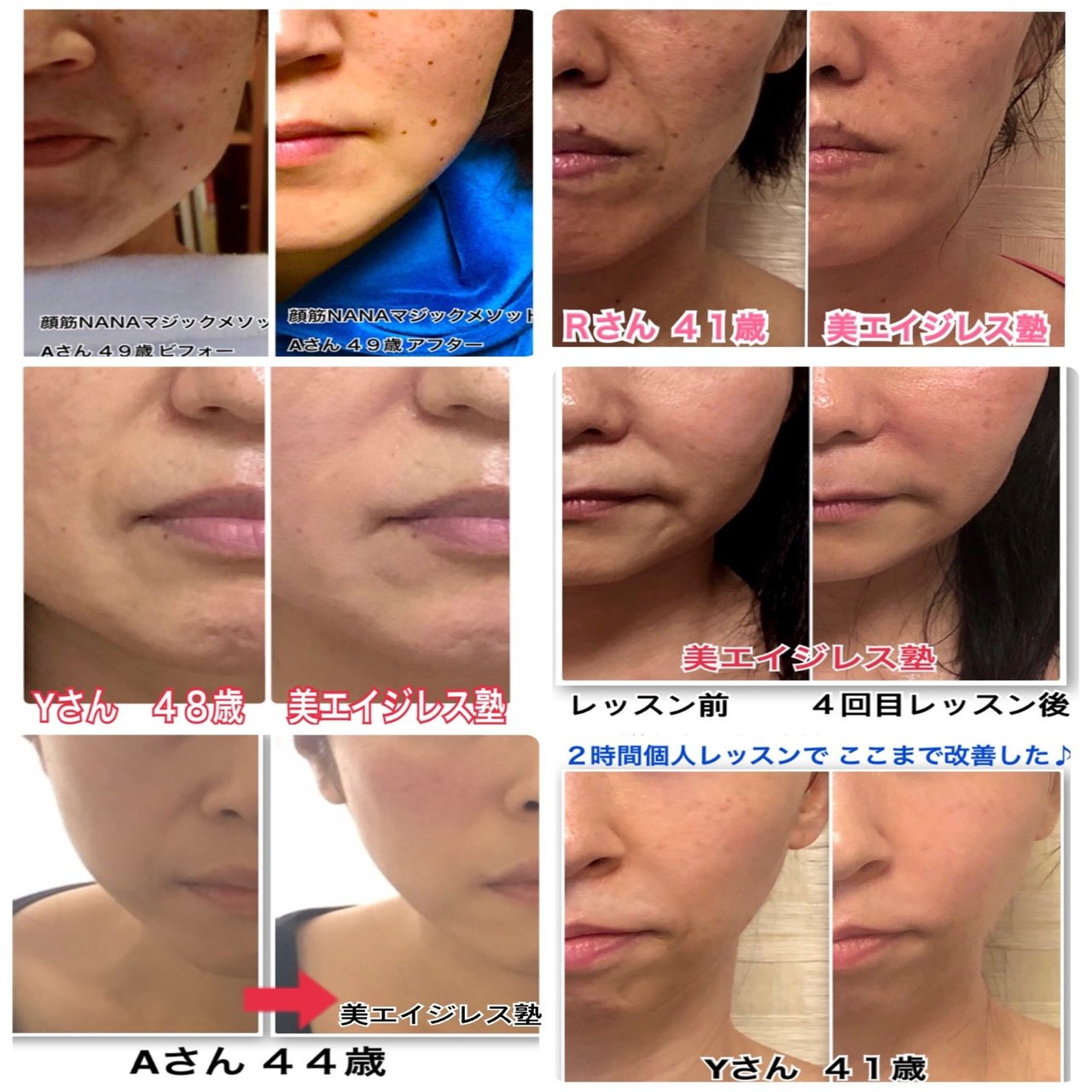 永久保存版】ほうれい線になる原因8つでほうれい線の予防と改善をする