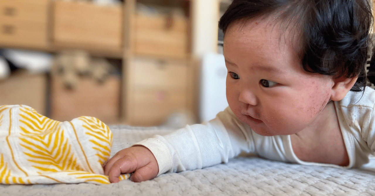 乳児湿疹 の新着タグ記事一覧 Note つくる つながる とどける