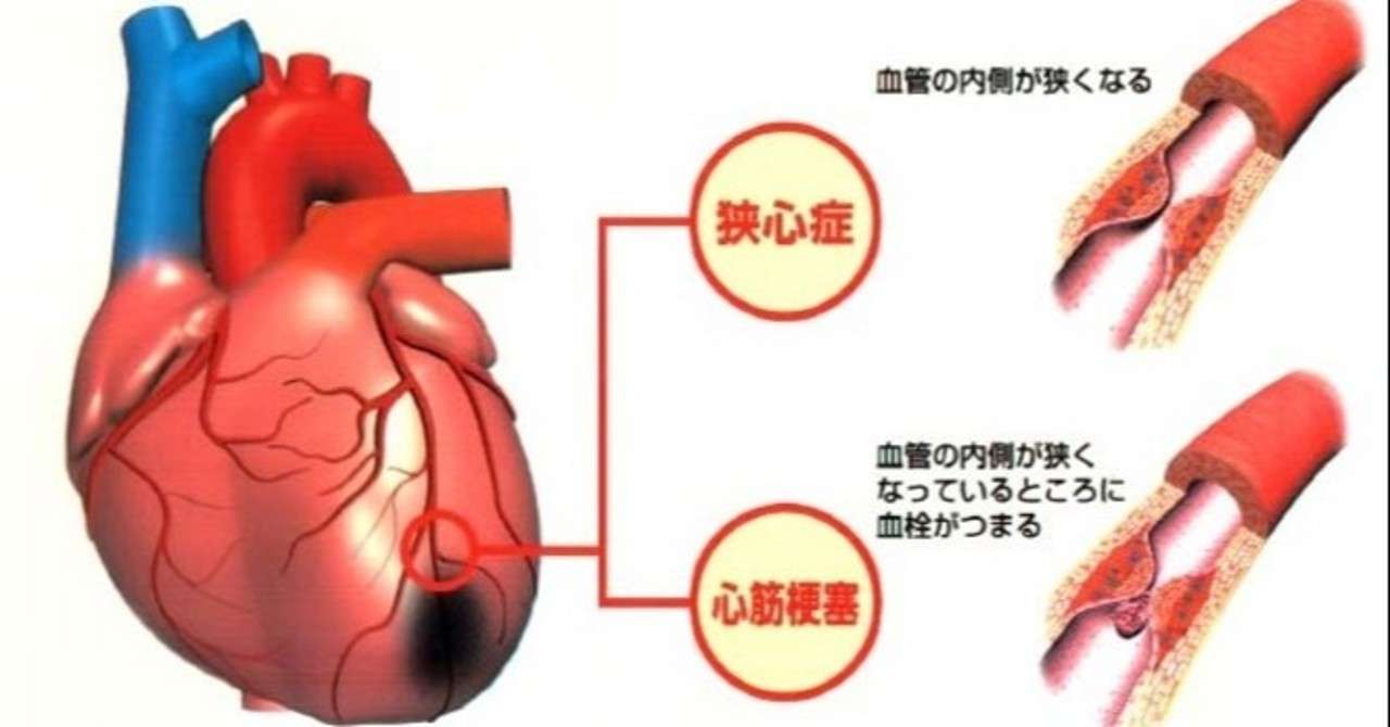 心臓病にはどんなものがある 医療法人七ふく会 ふくいクリニック Note