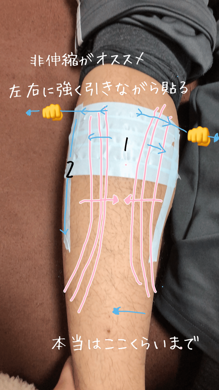 テーピング方法 1 モモ Note テーピング方法 1 モモ Note