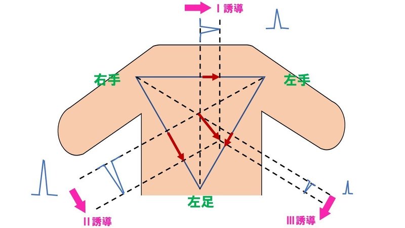 三角形 アイン トーベン の 正常心電図の基本