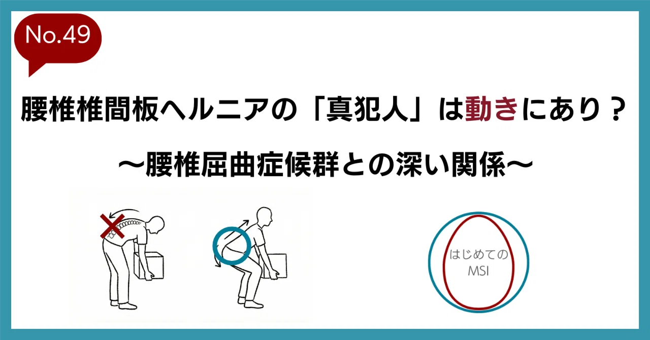 腰椎椎間板ヘルニアの「真犯人」は動きにあり？〜腰椎屈曲症候群との