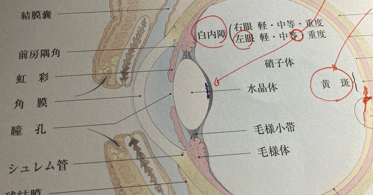 Financial Planner Uncle @ Cataract Surgery and High-Cost Medical ...