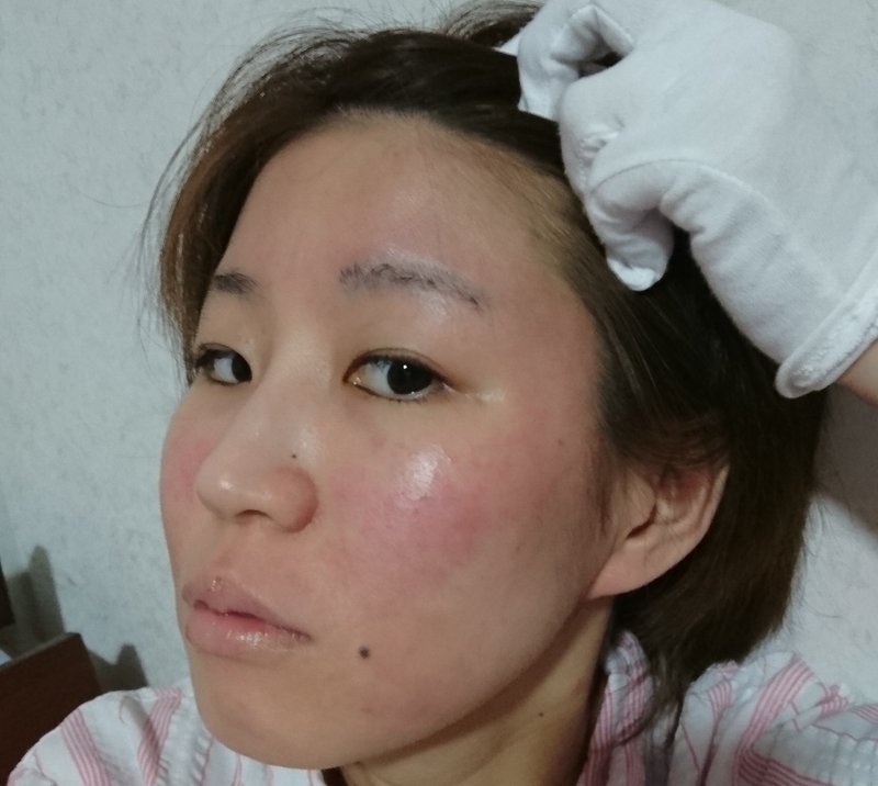 ビタミンb群摂取で顔の赤み軽減 白色ワセリンについて ダダノイア Note
