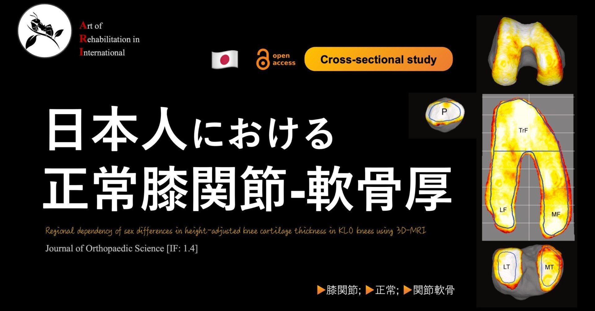 日本人における正常膝関節の軟骨厚｜Super Human | 理学療法士／保健学