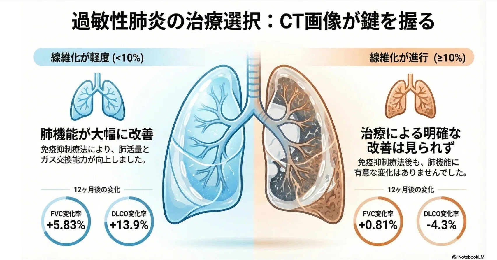 過敏性肺炎：画像所見が免疫抑制療法への反応を予測する『治療効果予測