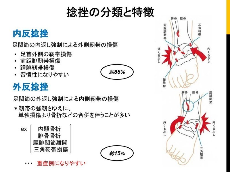 足関節捻挫の鑑別チェックポイント 骨次郎 Note