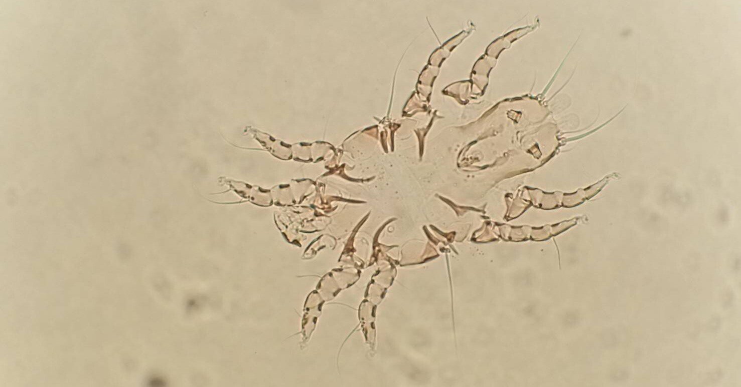 鳥の寄生虫を眺めてみる｜くまぐす