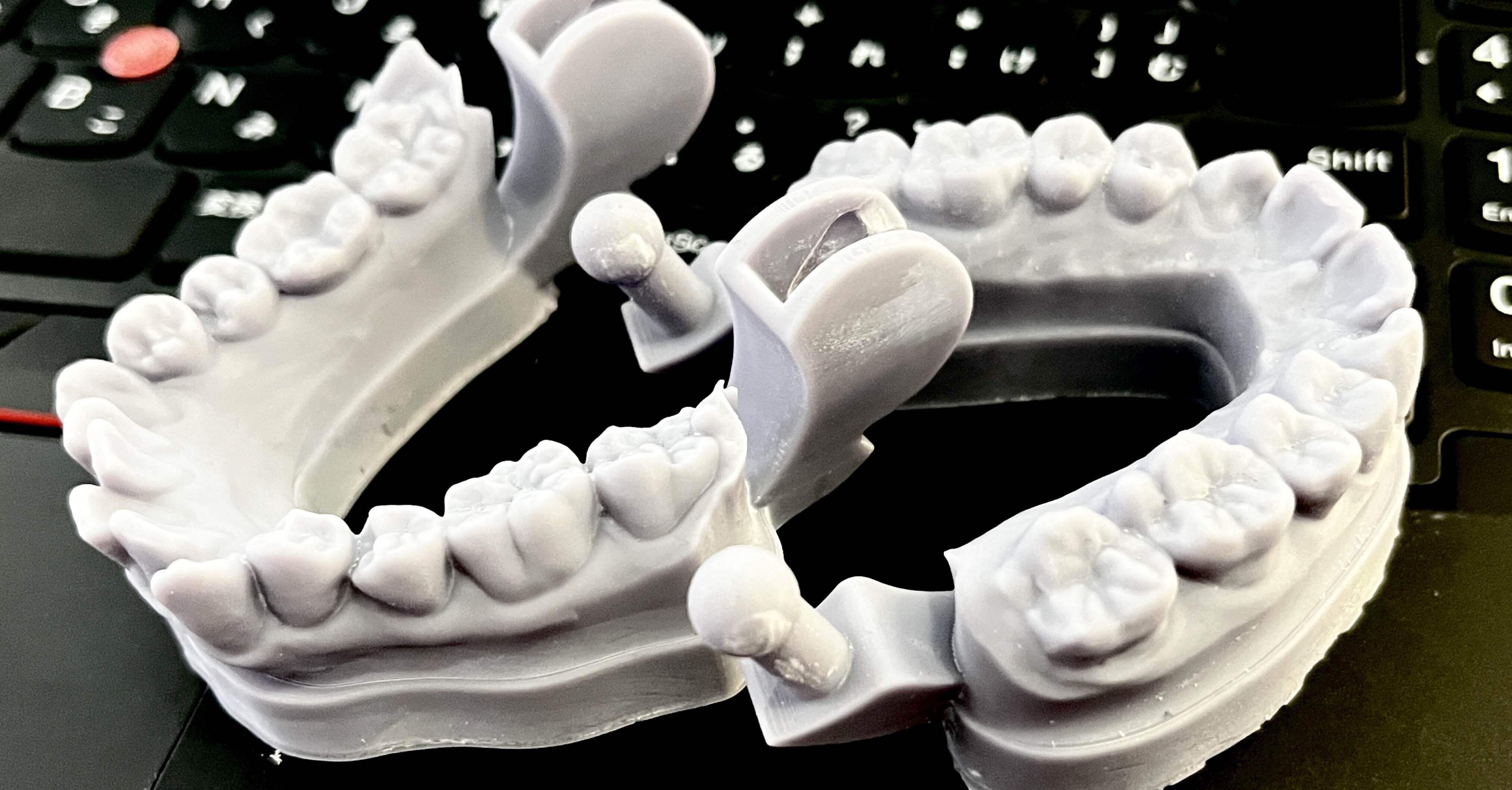咬合器付きの樹脂模型｜とある歯医者の備忘録