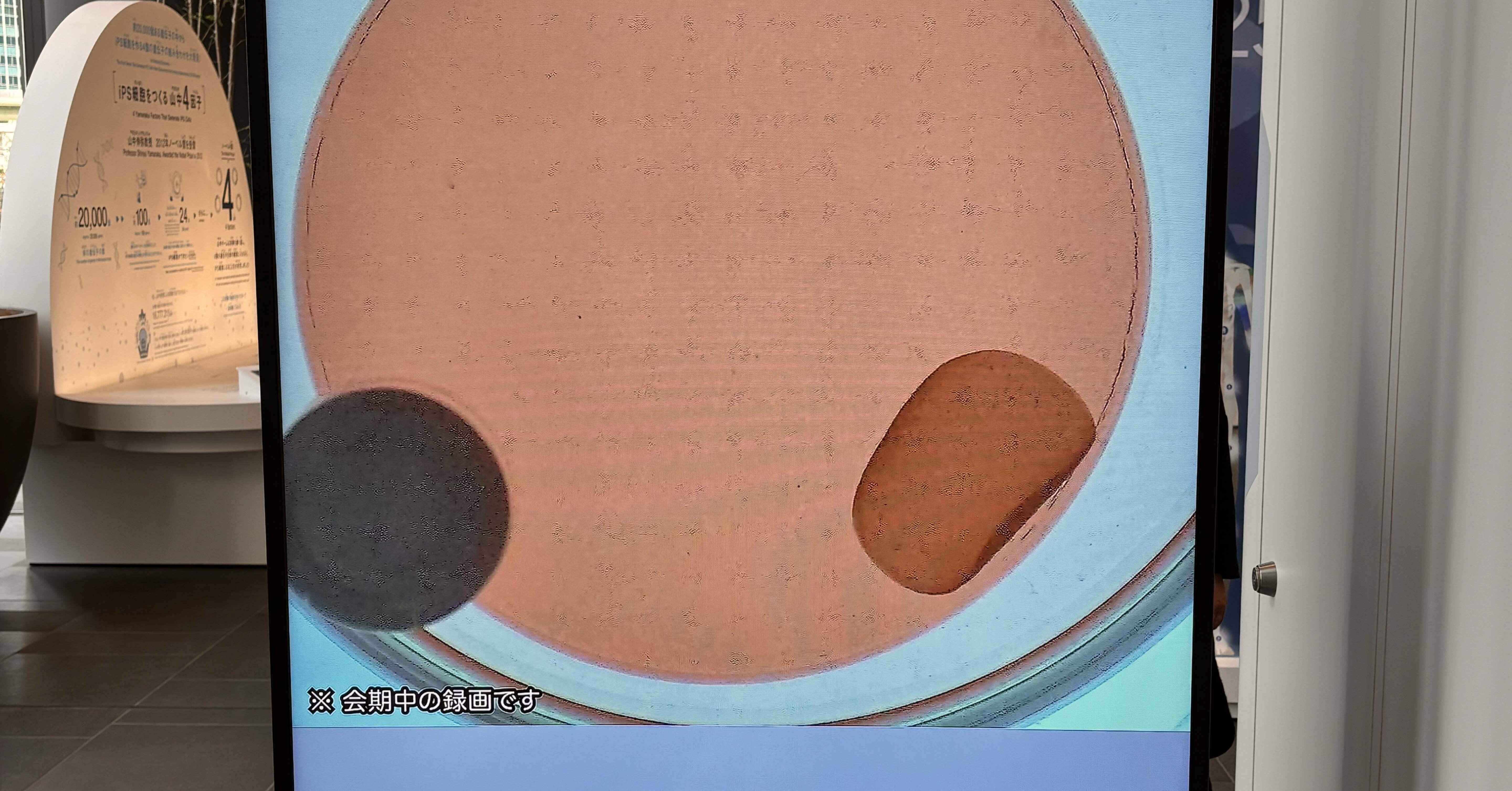 中之島クロスでiPS細胞を見てきた｜万博にも展示された“未来の医療