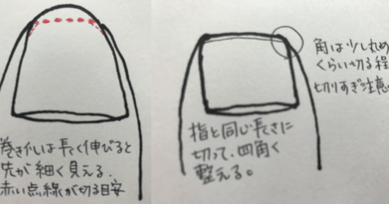 No 10 巻き爪 の切り方 高齢者を足から笑顔に 中西薫 Note