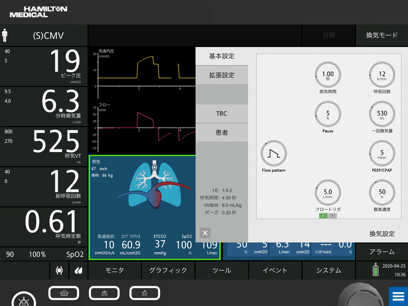 わかるまでずっと解説する人工呼吸器 Pcv Vcv ムロ 呼吸が好きな人 Note