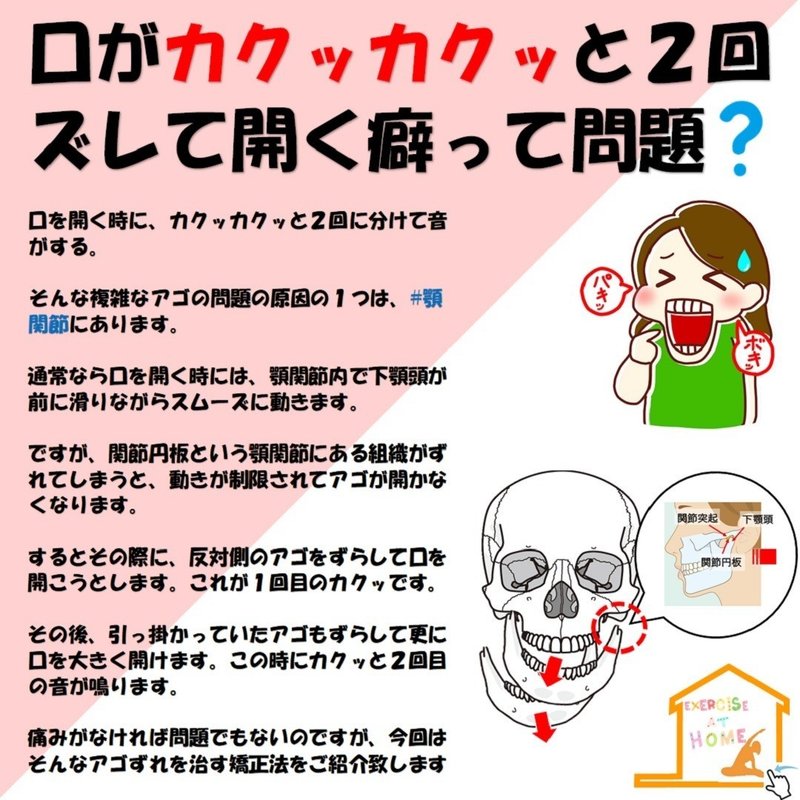 口がカクッカクッと2回ズレて開く癖って問題 Revisionginza Note 口がカクッカクッと2回ズレて開く癖って問題 Revisionginza Note