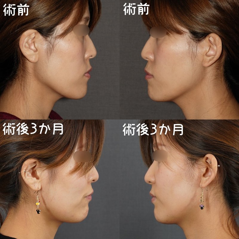 印刷可能 眉骨 出てる 芸能人 眉骨 出てる 芸能人 印刷可能 眉骨 出てる 芸能人 眉骨 出てる 芸能人