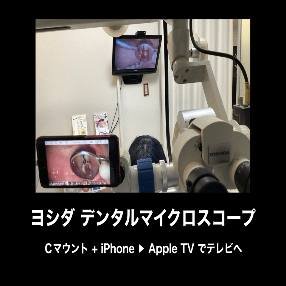 Windows PCの画面をApple TVで無線ミラーリングする方法｜とある歯医者