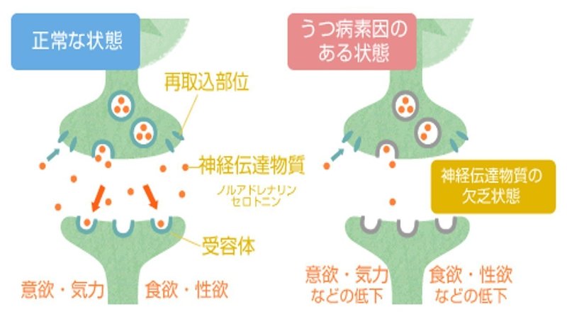 うつ病の治療 Ssri ヒデ Note