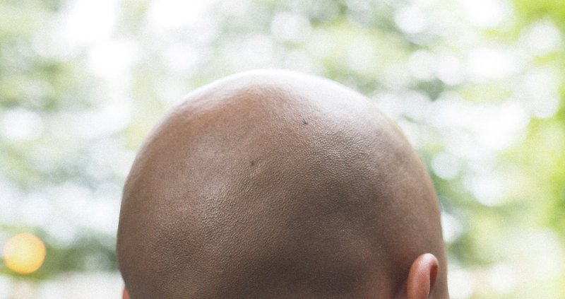 あなたの髪の毛ありますか ナズミロジック Note