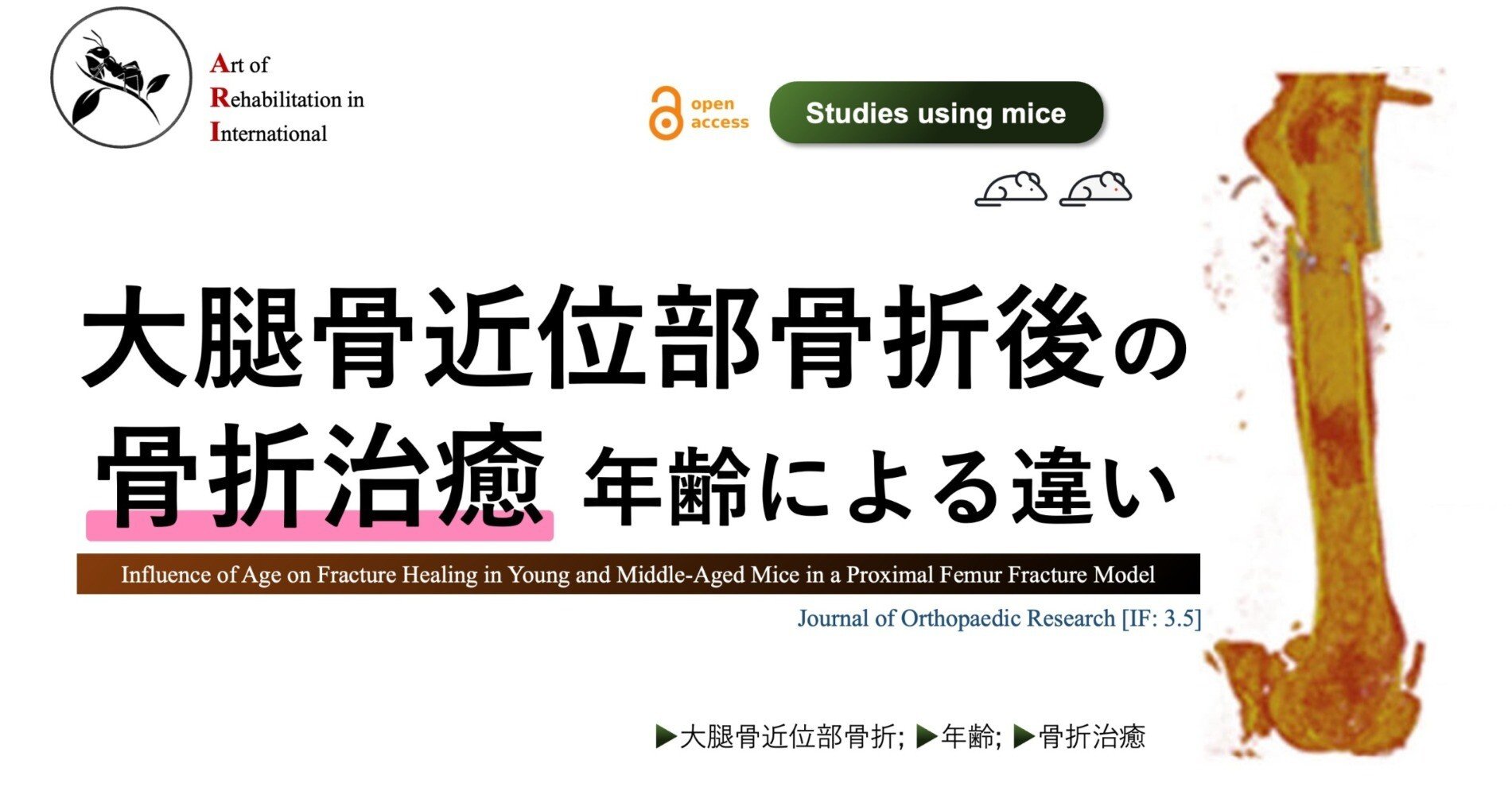 大腿骨近位部骨折後の骨折治癒。年齢による違い｜Super Human | 理学